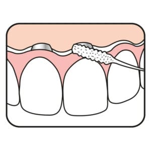 demonstration