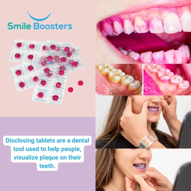 Make plaque removal fun and easy with #DisclosingTablets!⁠
⁠
A great way to teach kids (and adults!) the importance of brushing thoroughly. See, brush, and smile with confidence!⁠
⁠
🔹 Get yours now: www.smileboosters.com.au⁠
⁠
#SmileBoosters #PlaqueControl #OralHygieneFun #HealthySmile